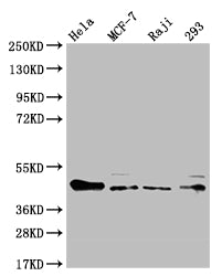 Western Blot
Positive WB detected in: Hela whole cell lysate, MCF-7 whole cell lysate, Raji whole cell lysate, HEK293 whole cell lysate
All lanes: ULBP1 antibody at 1:1000
Secondary
Goat polyclonal to rabbit IgG at 1/50000 dilution
Predicted band size: 28 kDa
Observed band size: 36-50 kDa