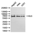 Western Blot, 
Positive WB detected in:HepG2 whole cell lysate(30µg), Hela whole cell lysate(30µg), U251 whole cell lysate(30µg)
All lanes: GLS antibody at 1:1000
Secondary
Goat polyclonal to rabbit IgG at 1/40000 dilution
Predicted band size: 73 kDa
Observed band size: 62, 73 kDa
Exposure time：30s