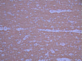 IHC image of CSB-RA545009A0HU diluted at 1:100 and staining in paraffin-embedded human brain tissue performed on a Leica BondTM system. After dewaxing and hydration, antigen retrieval was mediated by high pressure in a citrate buffer (pH 6.0). Section was blocked with 10% normal goat serum 30min at RT. Then primary antibody (1% BSA) was incubated at 4°C overnight. The primary is detected by a Goat anti-rabbit polymer IgG labeled by HRP and visualized using 0.05% DAB.