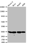 Western Blot
Positive WB detected in: Ntera-2 whole cell lysate, Hela whole cell lysate, HepG2 whole cell lysate, A549 whole cell lysate
All lanes: FGF19 antibody at 1:500
Secondary
Goat polyclonal to rabbit IgG at 1/50000 dilution
Predicted band size: 25 kDa
Observed band size: 36 kDa