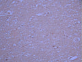 IHC image of CSB-RA546087A0HU diluted at 1:100 and staining in paraffin-embedded human brain tissue performed on a Leica BondTM system. After dewaxing and hydration, antigen retrieval was mediated by high pressure in a citrate buffer (pH 6.0). Section was blocked with 10% normal goat serum 30min at RT. Then primary antibody (1% BSA) was incubated at 4°C overnight. The primary is detected by a Goat anti-rabbit polymer IgG labeled by HRP and visualized using 0.05% DAB.