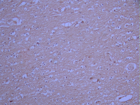 IHC image of CSB-RA546087A0HU diluted at 1:100 and staining in paraffin-embedded human brain tissue performed on a Leica BondTM system. After dewaxing and hydration, antigen retrieval was mediated by high pressure in a citrate buffer (pH 6.0). Section was blocked with 10% normal goat serum 30min at RT. Then primary antibody (1% BSA) was incubated at 4°C overnight. The primary is detected by a Goat anti-rabbit polymer IgG labeled by HRP and visualized using 0.05% DAB.