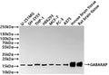 Western Blot
Positive WB detected in: U-251MG whole cell lysate(30µg) , SH-SY5Y whole cell lysate(30µg) , THP-1 whole cell lysate(30µg) , HEK293 whole cell lysate(30µg) , MCF-7 whole cell lysate(30µg) , PC-3 whole cell lysate(30µg) , A375 whole cell lysate(30µg) , Mouse brain tissue lysate(30µg) , Rat brain tissue lysate(30µg) 
All lanes: GABARAP antibody at 1:1000
Secondary
Goat polyclonal to rabbit IgG at 1/40000 dilution
Predicted band size: 14 kDa
Observed band size: 17 kDa
Exposure time：2min