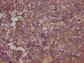 RHOA Antibody – Figure 1 of 1