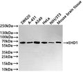 Western Blot
Positive WB detected in: SW620 whole cell lysate(30µg) , A-431 whole cell lysate(30µg) , A549 whole cell lysate(30µg) , HeLa whole cell lysate, NIH/3T3 whole cell lysate(30µg) , Mouse brain tissue lysate(30µg) 
All lanes: EHD1 antibody at 1:1000
Secondary
Goat polyclonal to rabbit IgG at 1/50000 dilution
Predicted band size: 61 kDa
Observed band size: 61 kDa
Exposure time: 3min