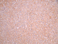IHC image of CSB-RA547483A0HU diluted at 1:100 and staining in paraffin-embedded human liver tissue performed on a Leica BondTM system. After dewaxing and hydration, antigen retrieval was mediated by high pressure in a citrate buffer (pH 6.0). Section was blocked with 10% normal goat serum 30min at RT. Then primary antibody (1% BSA) was incubated at 4°C overnight. The primary is detected by a Goat anti-rabbit polymer IgG labeled by HRP and visualized using 0.05% DAB.