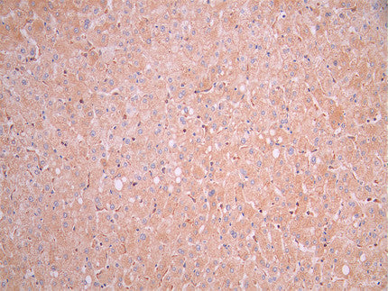 IHC image of CSB-RA547483A0HU diluted at 1:100 and staining in paraffin-embedded human liver tissue performed on a Leica BondTM system. After dewaxing and hydration, antigen retrieval was mediated by high pressure in a citrate buffer (pH 6.0). Section was blocked with 10% normal goat serum 30min at RT. Then primary antibody (1% BSA) was incubated at 4°C overnight. The primary is detected by a Goat anti-rabbit polymer IgG labeled by HRP and visualized using 0.05% DAB.