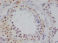 IHC image of CSB-RA547973A0HU diluted at 1:100 and staining in paraffin-embedded human testis tissue performed on a Leica BondTM system. After dewaxing and hydration, antigen retrieval was mediated by high pressure in a citrate buffer (pH 6.0) . Section was blocked with 10% normal goat serum 30min at RT. Then primary antibody (1% BSA) was incubated at 4°C overnight. The primary is detected by a Goat anti-rabbit polymer IgG labeled by HRP and visualized using 0.05% DAB.