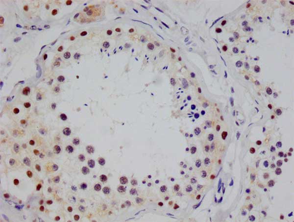IHC image of CSB-RA547973A0HU diluted at 1:100 and staining in paraffin-embedded human testis tissue performed on a Leica BondTM system. After dewaxing and hydration, antigen retrieval was mediated by high pressure in a citrate buffer (pH 6.0) . Section was blocked with 10% normal goat serum 30min at RT. Then primary antibody (1% BSA) was incubated at 4°C overnight. The primary is detected by a Goat anti-rabbit polymer IgG labeled by HRP and visualized using 0.05% DAB.