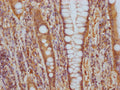 ITGAV Antibody – Figure 1 of 2