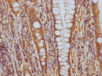 ITGAV Antibody – Figure 1 of 2