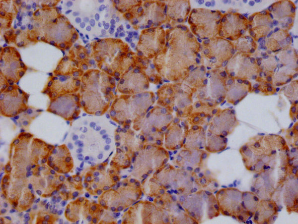 IHC image of CSB-RA548305A0HU diluted at 1:100 and staining in paraffin-embedded human salivary gland tissue  performed on a Leica BondTM system. After dewaxing and hydration, antigen retrieval was mediated by high pressure in a citrate buffer (pH 6.0) . Section was blocked with 10% normal goat serum 30min at RT. Then primary antibody (1% BSA) was incubated at 4°C overnight. The primary is detected by a Goat anti-rabbit polymer IgG labeled by HRP and visualized using 0.05% DAB.