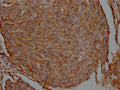 FLNA Antibody – Figure 1 of 1