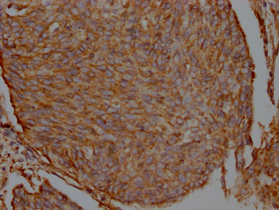 FLNA Antibody – Figure 1 of 1