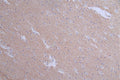 IHC image of CSB-RA549607A0HU diluted at 1:50 and staining in paraffin-embedded human brain tissue performed on a Leica BondTM system. After dewaxing and hydration, antigen retrieval was mediated by high pressure in a citrate buffer (pH 6.0) . Section was blocked with 10% normal goat serum 30min at RT. Then primary antibody (1% BSA) was incubated at 4°C overnight. The primary is detected by a Goat anti-rabbit polymer IgG labeled by HRP and visualized using 0.1:50% DAB.