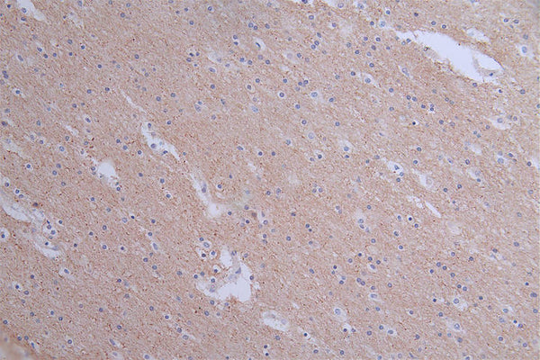 IHC image of CSB-RA549607A0HU diluted at 1:50 and staining in paraffin-embedded human brain tissue performed on a Leica BondTM system. After dewaxing and hydration, antigen retrieval was mediated by high pressure in a citrate buffer (pH 6.0) . Section was blocked with 10% normal goat serum 30min at RT. Then primary antibody (1% BSA) was incubated at 4°C overnight. The primary is detected by a Goat anti-rabbit polymer IgG labeled by HRP and visualized using 0.1:50% DAB.