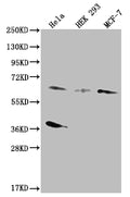 Western Blot
Positive WB detected in: Hela whole cell lysate, HEK293 whole cell lysate, MCF-7 whole cell lysate
All lanes: SMAD4 antibody at 1:500
Secondary
Goat polyclonal to rabbit IgG at 1/50000 dilution
Predicted band size: 61 kDa
Observed band size: 55-72 kDa