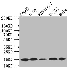 Western Blot
Positive WB detected in: HepG2 whole cell lysate,U87 whole cell lysate,RAW264.7 whole cell lysate,U251 whole cell lysate,Hela whole cell lysate
All lanes: LC3B antibody at 1:500
Secondary
Goat polyclonal to rabbit IgG at 1/50000 dilution
Predicted band size: 15 kDa
Observed band size: 15 kDa