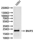 Western Blot
Positive WB detected in: U-251MG whole cell lysate(30µg)
All lanes:BNIP3 antibody at 1:1000
Secondary
Goat polyclonal to rabbit IgG at 1/40000 dilution
Predicted band size: 22 kDa
Observed band size: 22 kDa
Exposure time：2min