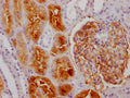 IHC image of CSB-RA552900A0HU diluted at 1:100 and staining in paraffin-embedded human kidney tissue performed on a Leica BondTM system. After dewaxing and hydration, antigen retrieval was mediated by high pressure in a citrate buffer (pH 6.0) . Section was blocked with 10% normal goat serum 30min at RT. Then primary antibody (1% BSA) was incubated at 4℃ overnight. The primary is detected by a Goat anti-rabbit IgG polymer labeled by HRP and visualized using 0.05% DAB.