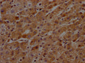 IHC image of CSB-RA553053A0HU diluted at 1:100 and staining in paraffin-embedded human liver tissue performed on a Leica BondTM system. After dewaxing and hydration, antigen retrieval was mediated by high pressure in a citrate buffer (pH 6.0) . Section was blocked with 10% normal goat serum 30min at RT. Then primary antibody (1% BSA) was incubated at 4℃ overnight. The primary is detected by a Goat anti-rabbit IgG polymer labeled by HRP and visualized using 0.05% DAB.