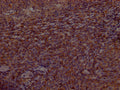 IHC image of CSB-RA553167A0HU diluted at 1:100 and staining in paraffin-embedded human tonsil tissue performed on a Leica BondTM system. After dewaxing and hydration, antigen retrieval was mediated by high pressure in a citrate buffer (pH 6.0) . Section was blocked with 10% normal goat serum 30min at RT. Then primary antibody (1% BSA) was incubated at 4℃ overnight. The primary is detected by a Goat anti-rabbit IgG polymer labeled by HRP and visualized using 0.05% DAB.