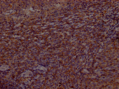 IHC image of CSB-RA553167A0HU diluted at 1:100 and staining in paraffin-embedded human tonsil tissue performed on a Leica BondTM system. After dewaxing and hydration, antigen retrieval was mediated by high pressure in a citrate buffer (pH 6.0) . Section was blocked with 10% normal goat serum 30min at RT. Then primary antibody (1% BSA) was incubated at 4℃ overnight. The primary is detected by a Goat anti-rabbit IgG polymer labeled by HRP and visualized using 0.05% DAB.