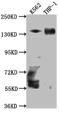 Western Blot
Positive WB detected in: K562 whole cell lysate, THP-1 whole cell lysate
All lanes: TACC3 Antibody at 1:1000
Secondary
Goat polyclonal to rabbit IgG at 1/50000 dilution
Predicted band size: 91 kDa
Observed band size: 140 kDa