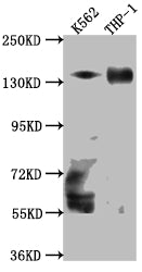 Western Blot
Positive WB detected in: K562 whole cell lysate, THP-1 whole cell lysate
All lanes: TACC3 Antibody at 1:1000
Secondary
Goat polyclonal to rabbit IgG at 1/50000 dilution
Predicted band size: 91 kDa
Observed band size: 140 kDa