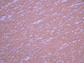 IHC image of CSB-RA554616A0HU diluted at 1:100 and staining in paraffin-embedded human brain tissue performed on a Leica BondTM system. After dewaxing and hydration, antigen retrieval was mediated by high pressure in a citrate buffer (pH 6.0). Section was blocked with 10% normal goat serum 30min at RT. Then primary antibody (1% BSA) was incubated at 4°C overnight. The primary is detected by a Goat anti-rabbit polymer IgG labeled by HRP and visualized using 0.05% DAB.