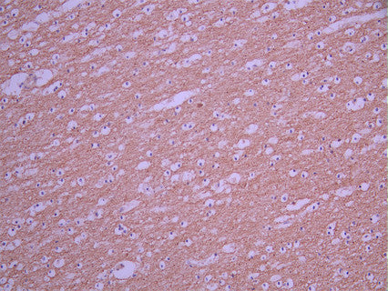 IHC image of CSB-RA554616A0HU diluted at 1:100 and staining in paraffin-embedded human brain tissue performed on a Leica BondTM system. After dewaxing and hydration, antigen retrieval was mediated by high pressure in a citrate buffer (pH 6.0). Section was blocked with 10% normal goat serum 30min at RT. Then primary antibody (1% BSA) was incubated at 4°C overnight. The primary is detected by a Goat anti-rabbit polymer IgG labeled by HRP and visualized using 0.05% DAB.