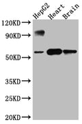 Western Blot
Positive WB detected in: HepG2 whole cell lysate, Rat Heart whole cell lysate, Rat Brain whole cell lysate
All lanes: CYP17A1 antibody at 1:1000
Secondary
Goat polyclonal to rabbit IgG at 1/50000 dilution
Predicted band size: 58 kDa
Observed band size: 58 kDa