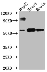 Western Blot
Positive WB detected in: HepG2 whole cell lysate, Rat Heart whole cell lysate, Rat Brain whole cell lysate
All lanes: CYP17A1 antibody at 1:1000
Secondary
Goat polyclonal to rabbit IgG at 1/50000 dilution
Predicted band size: 58 kDa
Observed band size: 58 kDa