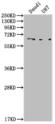 ACVRL1 Antibody – Figure 1 of 2