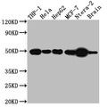 Western Blot
Positive WB detected in: THP-1 whole cell lysate, Hela whole cell lysate, HepG2 whole cell lysate, MCF-7 whole cell lysate, Ntera-2 whole cell lysate, Mouse Brain whole cell lysate
All lanes: TACR1 antibody at 1:1000
Secondary
Goat polyclonal to rabbit IgG at 1/50000 dilution
Predicted band size: 47, 36 kDa
Observed band size: 50 kDa