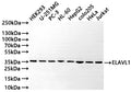 Western Blot
Positive WB detected in: HEK293 whole cell lysate(30µg) , U-251MG whole cell lysate(30µg) , PC-3 whole cell lysate(30µg) , HL-60 whole cell lysate(30µg) , HepG2 whole cell lysate(30µg) , COLO205 whole cell lysate(30µg) , HeLa whole cell lysate(30µg) , Jurkat whole cell lysate(30µg) 
All lanes: ELAVL1 antibody at 1:1000
Secondary
Goat polyclonal to rabbit IgG at 1/50000 dilution
Predicted band size: 36 kDa
Observed band size: 36 kDa
Exposure time: 10s