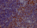 IHC image of CSB-RA556665A0HU diluted at 1:100 and staining in paraffin-embedded human tonsil tissue performed on a Leica BondTM system. After dewaxing and hydration, antigen retrieval was mediated by high pressure in a citrate buffer (pH 6.0) . Section was blocked with 10% normal goat serum 30min at RT. Then primary antibody (1% BSA) was incubated at 4℃ overnight. The primary is detected by a Goat anti-rabbit IgG polymer labeled by HRP and visualized using 0.05% DAB.