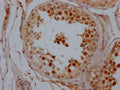 IHC image of CSB-RA556800A0HU diluted at 1:100 and staining in paraffin-embedded human testis tissue performed on a Leica BondTM system. After dewaxing and hydration, antigen retrieval was mediated by high pressure in a citrate buffer (pH 6.0) . Section was blocked with 10% normal goat serum 30min at RT. Then primary antibody (1% BSA) was incubated at 4℃ overnight. The primary is detected by a Goat anti-rabbit IgG polymer labeled by HRP and visualized using 0.05% DAB.