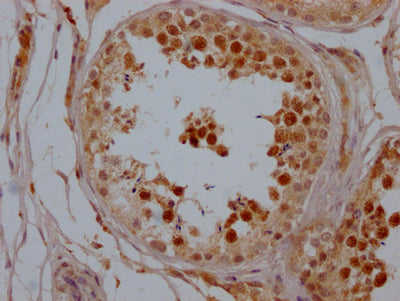 IHC image of CSB-RA556800A0HU diluted at 1:100 and staining in paraffin-embedded human testis tissue performed on a Leica BondTM system. After dewaxing and hydration, antigen retrieval was mediated by high pressure in a citrate buffer (pH 6.0) . Section was blocked with 10% normal goat serum 30min at RT. Then primary antibody (1% BSA) was incubated at 4℃ overnight. The primary is detected by a Goat anti-rabbit IgG polymer labeled by HRP and visualized using 0.05% DAB.