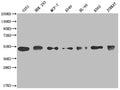 Western Blot
Positive WB detected in: U251 whole cell lysate, HEK293 whole cell lysate, MCF-7 whole cell lysate, A549 whole cell lysate, HL-60 whole cell lysate, K562 whole cell lysate, Jurkat whole cell lysate
All lanes: COPS3 antibody at 1:2000
Secondary
Goat polyclonal to rabbit IgG at 1/50000 dilution
Predicted band size: 48, 46 kDa
Observed band size: 40-55 kDa