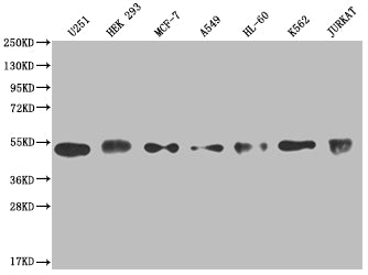 Western Blot
Positive WB detected in: U251 whole cell lysate, HEK293 whole cell lysate, MCF-7 whole cell lysate, A549 whole cell lysate, HL-60 whole cell lysate, K562 whole cell lysate, Jurkat whole cell lysate
All lanes: COPS3 antibody at 1:2000
Secondary
Goat polyclonal to rabbit IgG at 1/50000 dilution
Predicted band size: 48, 46 kDa
Observed band size: 40-55 kDa