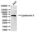 Western Blot, 
Positive WB detected in:A431 whole cell lysate(30µg)
All lanes: Cytokeratin 5 antibody at 1:1000
Secondary
Goat polyclonal to rabbit IgG at 1/40000 dilution
Predicted band size: 62 kDa
Observed band size:62 kDa
Exposure time：180s
