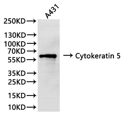 Western Blot, 
Positive WB detected in:A431 whole cell lysate(30µg)
All lanes: Cytokeratin 5 antibody at 1:1000
Secondary
Goat polyclonal to rabbit IgG at 1/40000 dilution
Predicted band size: 62 kDa
Observed band size:62 kDa
Exposure time：180s
