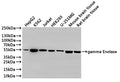 Western Blot
Positive WB detected in: HepG2 whole cell lysate(30µg), K562 whole cell lysate(30µg), Jurkat whole cell lysate(30µg), HEK293 whole cell lysate(30µg), U-251MG whole cell lysate(30µg), Mouse brain tissue lysate(30µg), Rat brain tissue lysate(30µg)
All lanes: gamma Enolase antibody at 1:1000
Secondary
Goat polyclonal to rabbit IgG at 1/40000 dilution
Predicted band size: 47 kDa
Observed band size: 47 kDa
Exposure time：1min