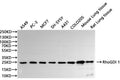 Western Blot, 
Positive WB detected in:A549 whole cell lysate(30µg), PC-3 whole cell lysate(30µg), MCF7 whole cell lysate(30µg), SH-SY5Y whole cell lysate(30µg), A431 whole cell lysate(30µg), COLO205 whole cell lysate(30µg), Mouse lung tissue lysate(30µg), Rat lung lysate(30µg)
All lanes: RhoGDI 1 antibody at 1:1000
Secondary
Goat polyclonal to rabbit IgG at 1/40000 dilution
Predicted band size: 23 kDa
Observed band size: 25 kDa
Exposure time：60s