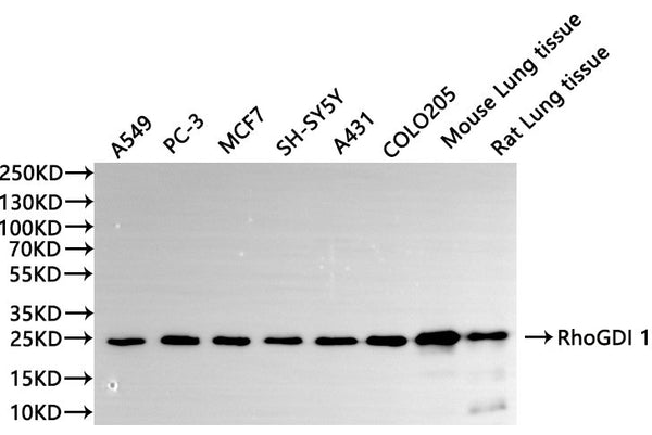 Western Blot, 
Positive WB detected in:A549 whole cell lysate(30µg), PC-3 whole cell lysate(30µg), MCF7 whole cell lysate(30µg), SH-SY5Y whole cell lysate(30µg), A431 whole cell lysate(30µg), COLO205 whole cell lysate(30µg), Mouse lung tissue lysate(30µg), Rat lung lysate(30µg)
All lanes: RhoGDI 1 antibody at 1:1000
Secondary
Goat polyclonal to rabbit IgG at 1/40000 dilution
Predicted band size: 23 kDa
Observed band size: 25 kDa
Exposure time：60s