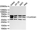 Western Blot
Positive WB detected in: Jurkat whole cell lysate(30µg) , HT-29 whole cell lysate(30µg) , A431 whole cell lysate(30µg) , Hela whole cell lysate(30µg) 
All lanes: Lumican antibody at 1:1000
Secondary
Goat polyclonal to rabbit IgG at 1/40000 dilution
Predicted band size: 38 kDa
Observed band size: 38-58 kDa
Exposure time：10s