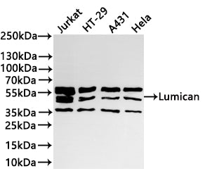 Western Blot
Positive WB detected in: Jurkat whole cell lysate(30µg) , HT-29 whole cell lysate(30µg) , A431 whole cell lysate(30µg) , Hela whole cell lysate(30µg) 
All lanes: Lumican antibody at 1:1000
Secondary
Goat polyclonal to rabbit IgG at 1/40000 dilution
Predicted band size: 38 kDa
Observed band size: 38-58 kDa
Exposure time：10s