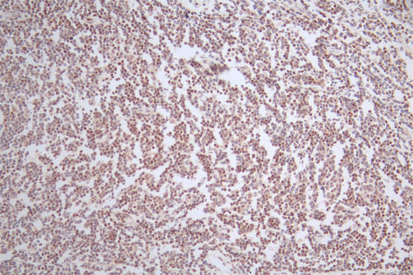 IHC image of CSB-RA561630A0HU diluted at 1:50 and staining in paraffin-embedded human tonsil tissue performed on a Leica BondTM system. After dewaxing and hydration, antigen retrieval was mediated by high pressure in a citrate buffer (pH 6.0) . Section was blocked with 10% normal goat serum 30min at RT. Then primary antibody (1% BSA) was incubated at 4°C overnight. The primary is detected by a Goat anti-rabbit polymer IgG labeled by HRP and visualized using 0.52% DAB.