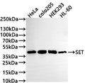 Western Blot
Positive WB detected in: HeLa whole cell lysate(30µg) , COLO205 whole cell lysate(30µg) , HEK293 whole cell lysate, HL-60 whole cell lysate(30µg) 
All lanes: SET antibody at 1:1000
Secondary
Goat polyclonal to rabbit IgG at 1/50000 dilution
Predicted band size: 33 kDa
Observed band size: 39 kDa
Exposure time: 2min